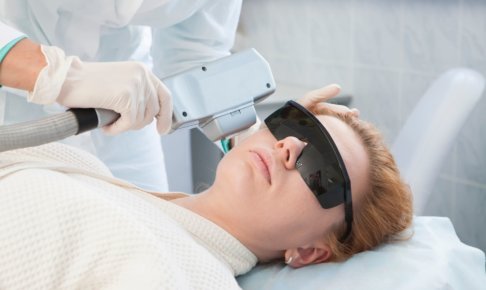 レーザー治療を受けている女性