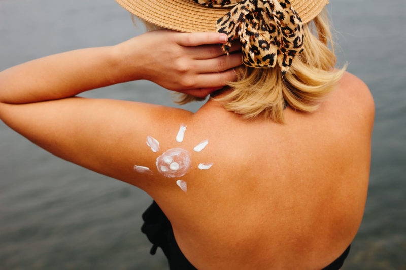 外人女性が日焼けした後姿の画像。肩には白いクリームで太陽のイラストが描かれている。
