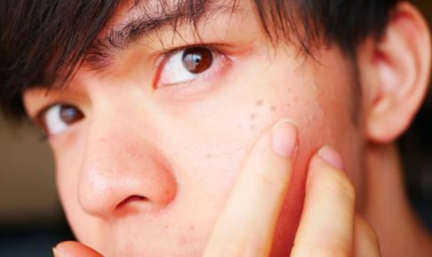 たるみをなんとかしたいメンズケア