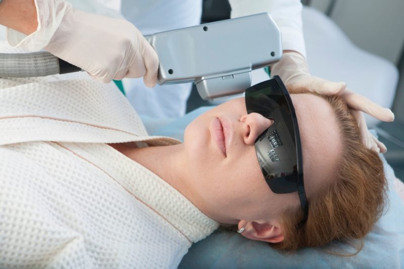 レーザー治療を受ける白人女性